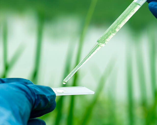 Analisi della legionella nelle Acque: il costo del campionamento